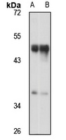 Anti-FOXL2 Antibody