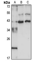 Anti-FOXR2 Antibody