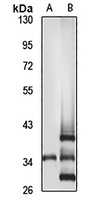 Anti-FKHL18 Antibody