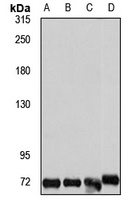 Anti-FREM1 Antibody