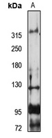 Anti-FREM2 Antibody