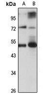 Anti-FUT7 Antibody