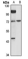 FUT8 antibody