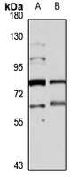 GABRR2 antibody