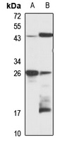 NOLA1 antibody