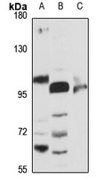 Anti-Beta-glucosidase 2 Antibody