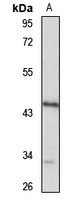 Anti-GCAT Antibody