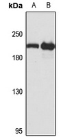 Anti-GCC2 Antibody