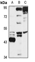 BMP3B antibody