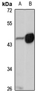 Anti-BMP9 Antibody