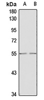 Anti-GDF5 Antibody