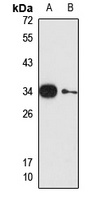 Anti-Gemin8 Antibody