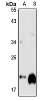 Anti-GGCT Antibody