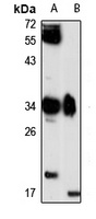 GIMAP5 antibody