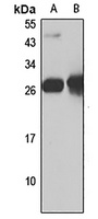 SLD5 antibody