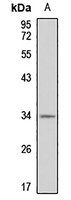 GIPC2 antibody