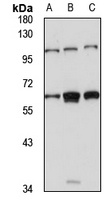 GLCCI1 antibody