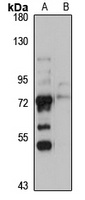 Anti-GLIS3 Antibody