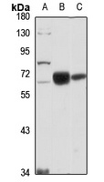 Anti-GLS2 Antibody