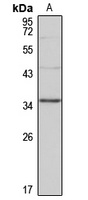 GLYAT antibody