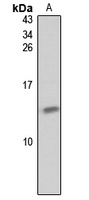 Anti-GNGT2 Antibody