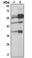 GNRHR antibody