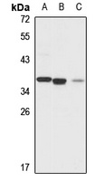 Anti-GOLPH3 Antibody