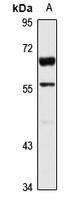 Anti-Glypican-6 Antibody