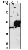 Anti-GPD1L Antibody