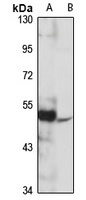 Anti-GPER Antibody