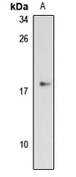 Anti-GPIHBP1 Antibody