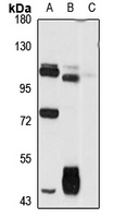 Anti-GPR133 Antibody