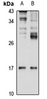 Anti-Gremlin-1 Antibody