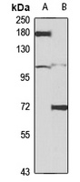 Anti-mGLUR3 Antibody