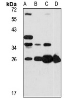 GSTA3 antibody