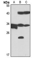 GSTO1 antibody
