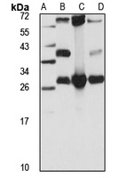 Anti-GSTT2 Antibody