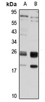 Anti-GUK1 Antibody