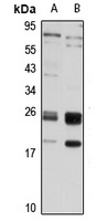 GUK1 antibody