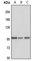 Anti-HACE1 Antibody
