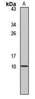 Hepcidin-25 antibody
