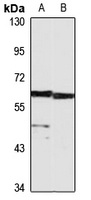 Anti-HAS1 Antibody