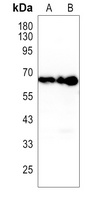Anti-HAS2 Antibody