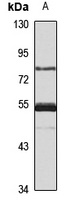 Anti-HBS1L Antibody