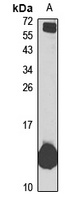 Anti-HBZ Antibody