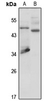 Anti-GPR109A Antibody