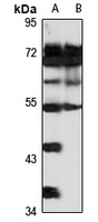 Anti-Orexin Receptor 1 Antibody