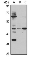 Anti-Orexin Receptor 2 Antibody