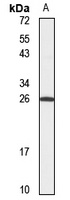 Anti-HEBP2 Antibody