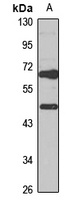 HGD antibody